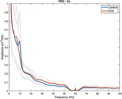 EEG Signal Complexity Is Reduced During Resting-State in Fragile X Syndrome